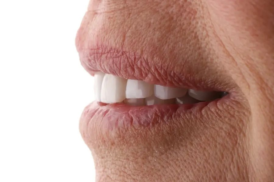 A close view of healthy upper front teeth.